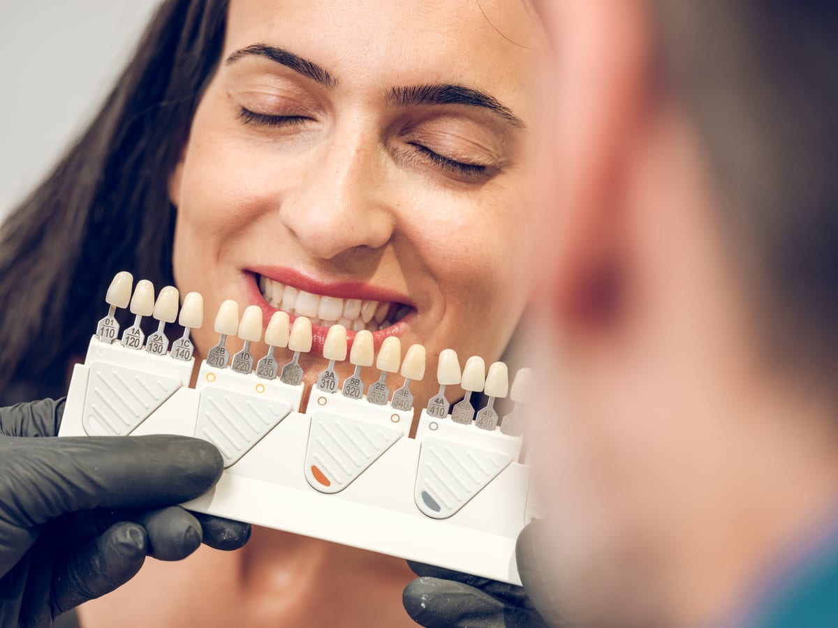 Veneers in New Kensington